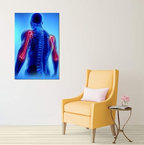 Wallario Leinwandbild Anatomie Mensch - Oberarmknochen - 60 x 90 cm in Premium-Qualität: Brillante lichtechte Farben, hochauflösend, verzugsfrei